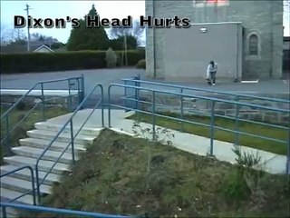 EPIC SKATEBOARD FAIL SMASHES HEAD