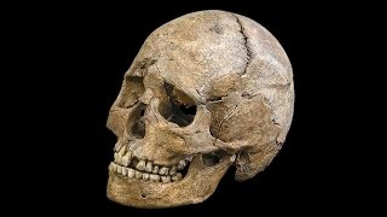 Anatomia Rara: Ossos (Dublado) - Documentário National Geographic
