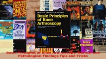 PDF Download  Basic Principles of Knee Arthroscopy Normal and Pathological Findings Tips and Tricks Download Online