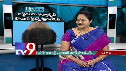 Baldness solutions in Hyderabad | Radiance