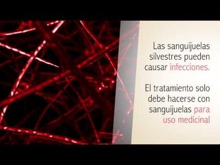 Terapia con Sanguijuelas