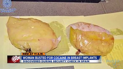 Top 5 Facts About Breast Implants