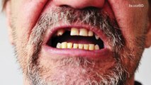 Brits actually have better teeth than Americans