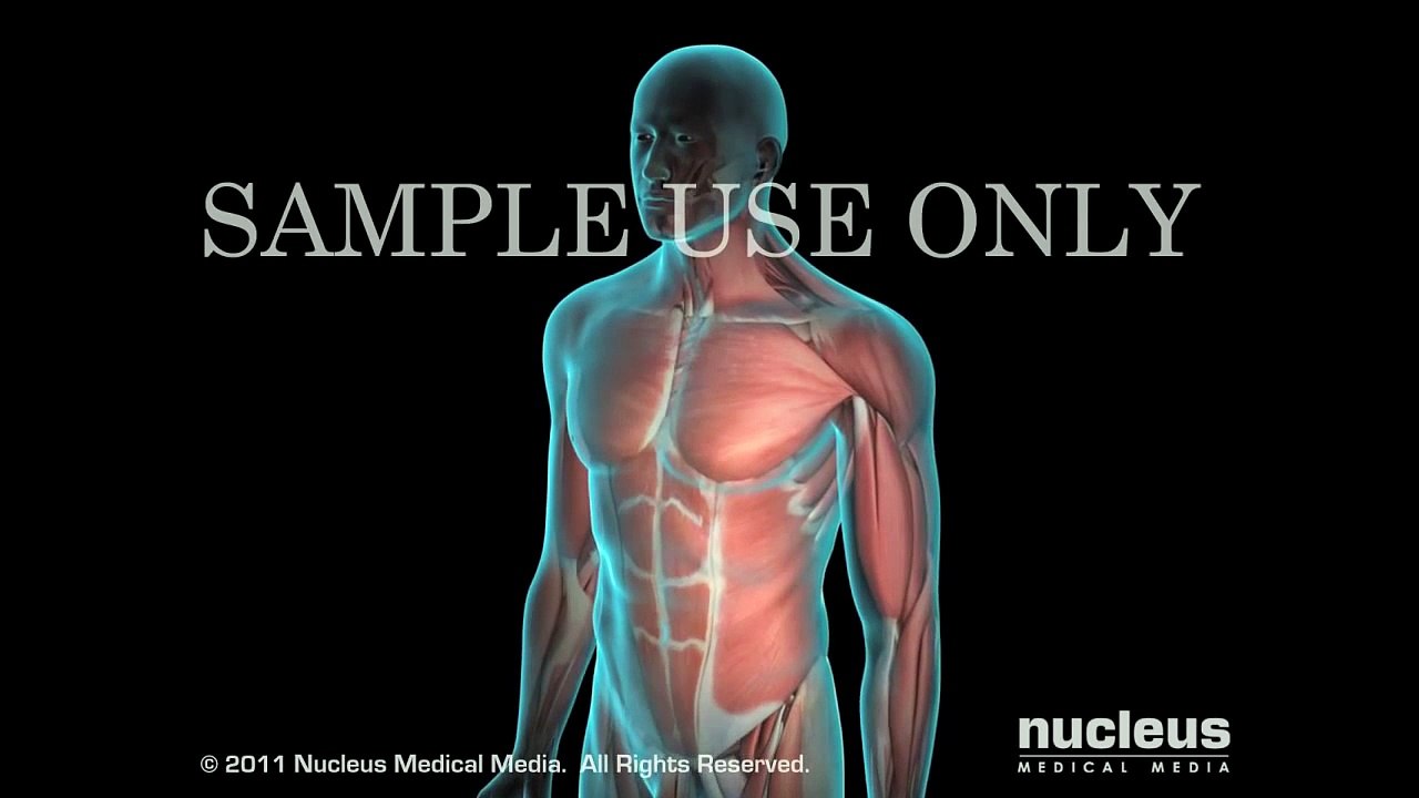 Patient Engagement Video- Low Testosterone