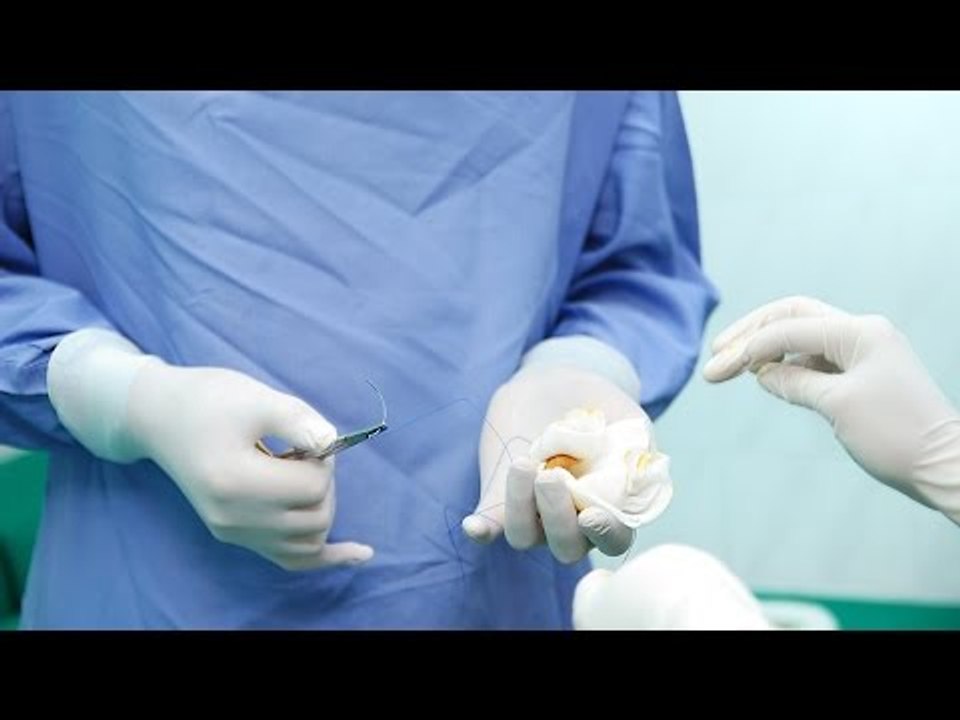 Massage Therapy and Fusion Surgery of the Lumbar Spine - Research Perch