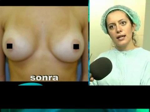 Göğüs büyütme silikon