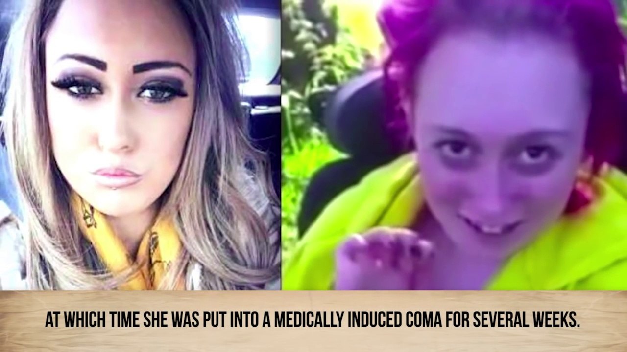 Shocking Before-And-After Drug Use Photos