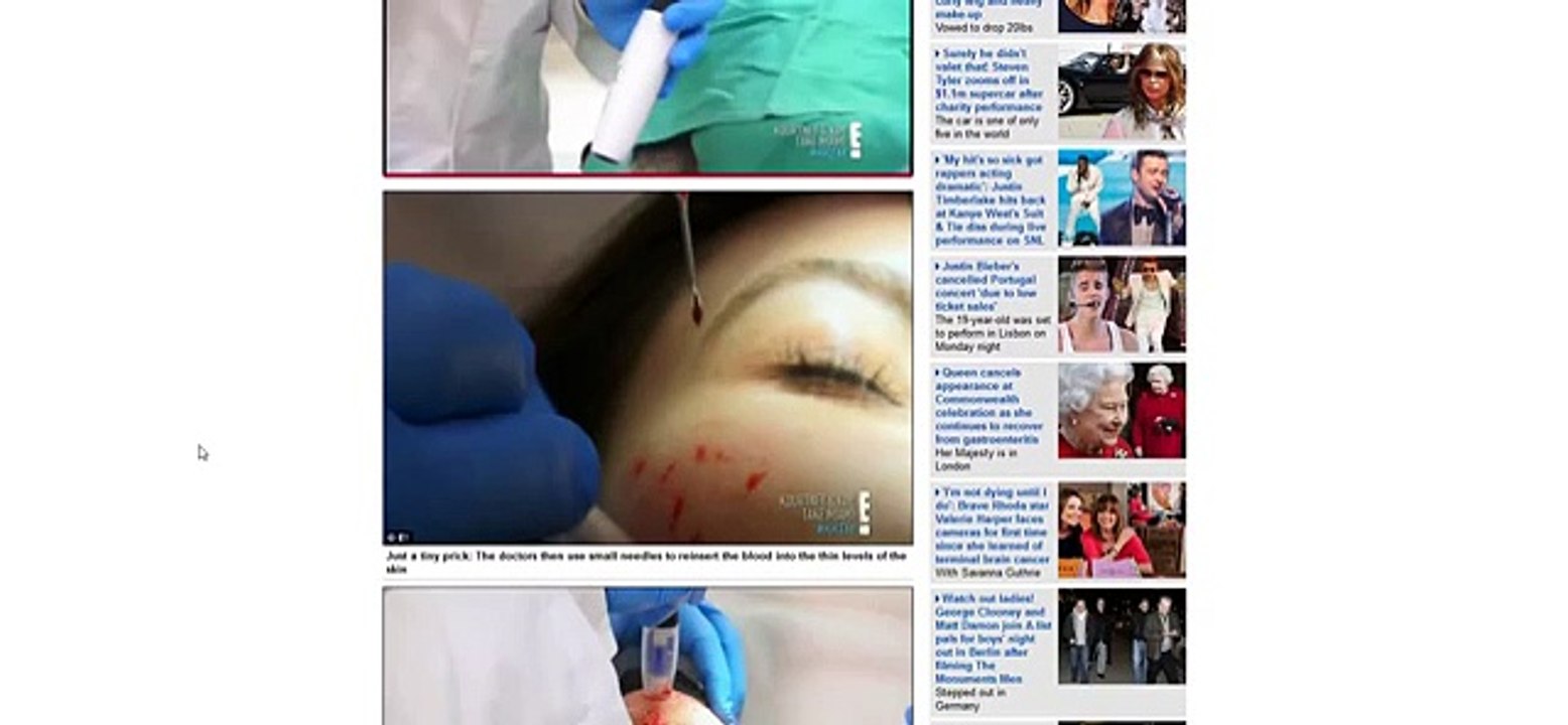 Bathes in Human Blood Trying to Stay Young