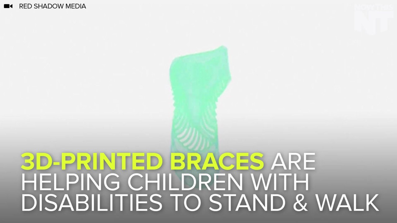 3D Printed Braces Help Kids With Disability Sta...