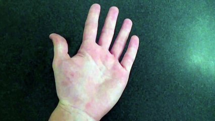 How to Snap Your Fingers