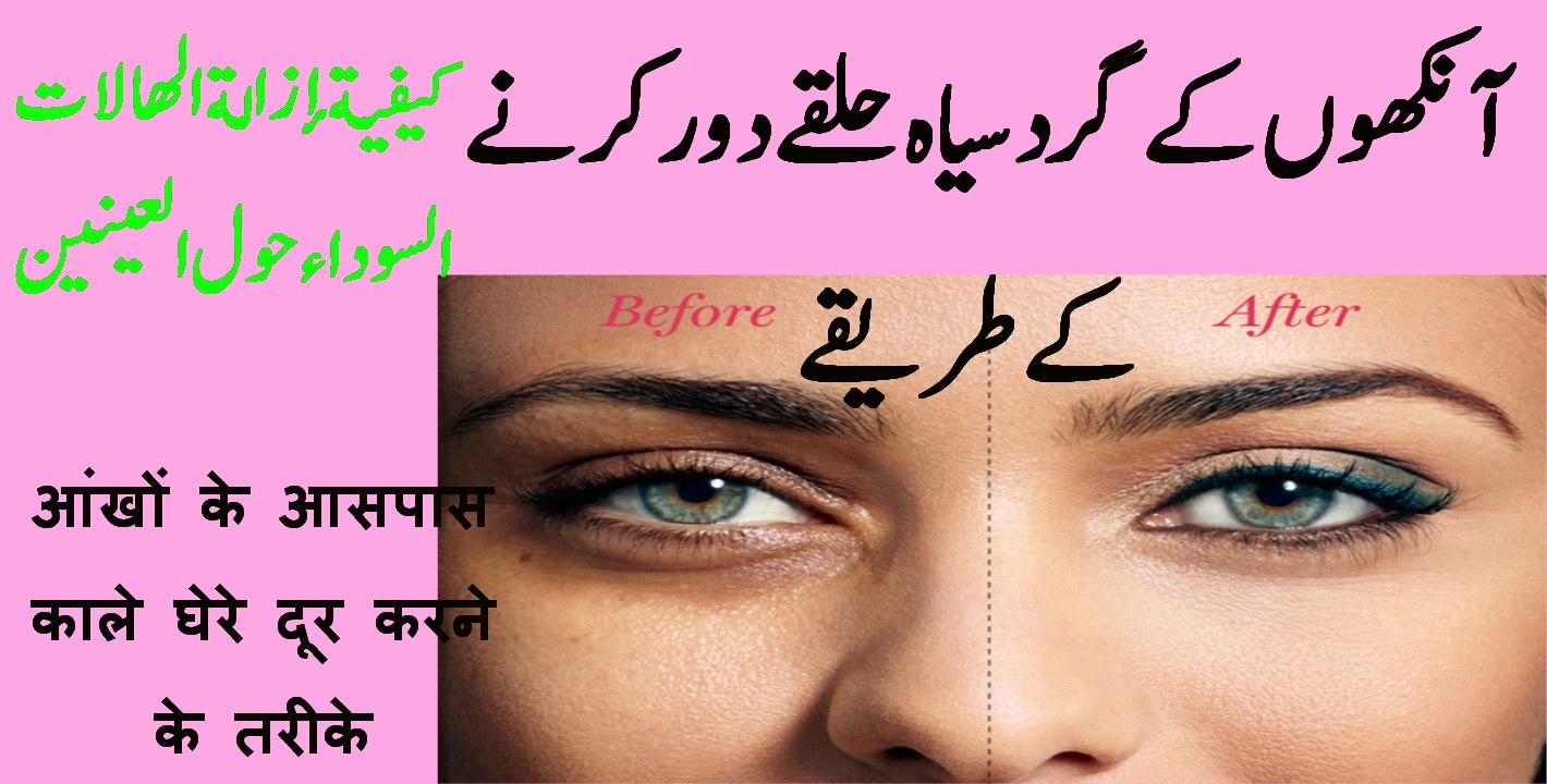 aankhon ke gird blackness khatam karne ke tareeqe