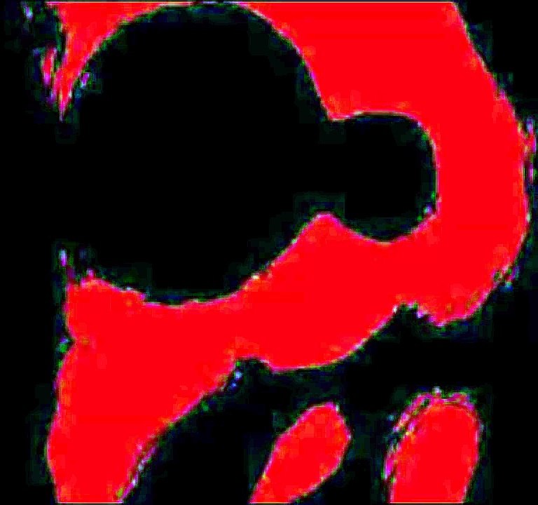 Onaf voices : The Redman