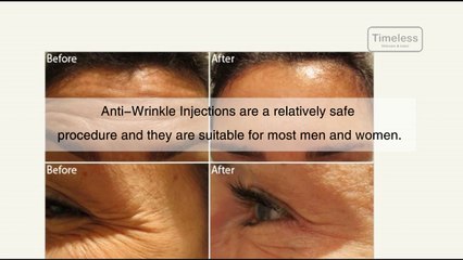 World-Class Hair Removal Treatment Offered By Timelessskincare.co.uk