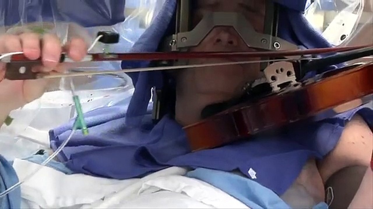 Violinist Still Making Music After DBS Surgery - Mayo Clinic