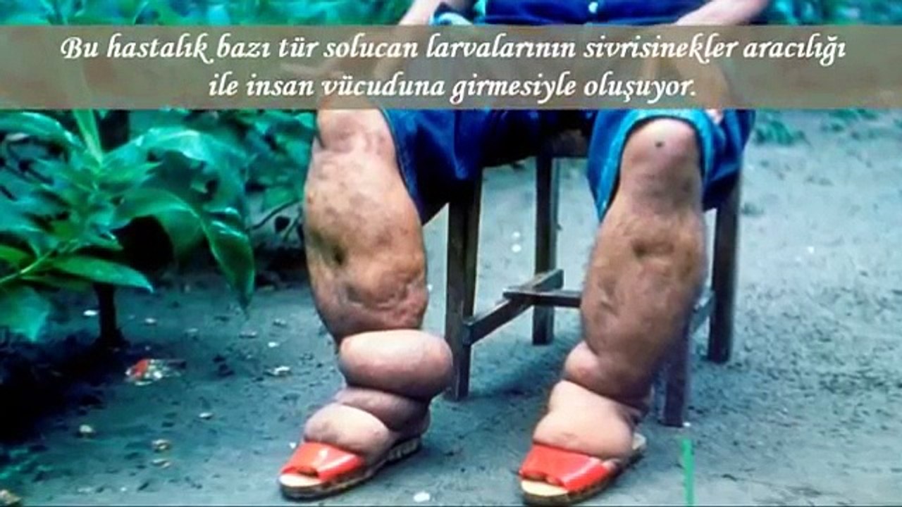 Dünyanın 10 Mucizevi Yaşamı
