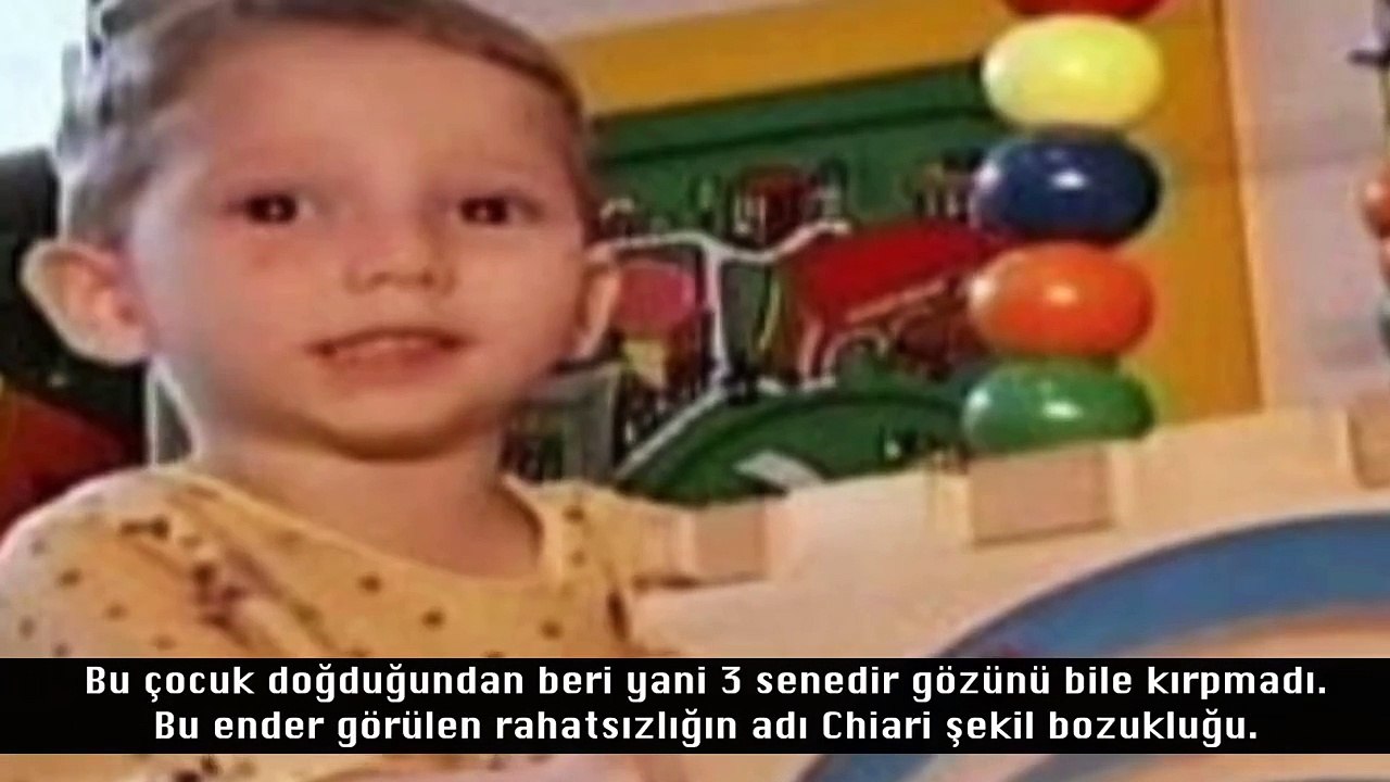 Dünyanın En ilginç Doğan 10 Bebeği
