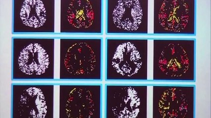 Hole in the Head - Science on the Web #56