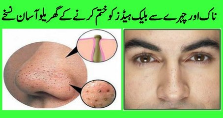 black heads on nose removal CHEHRE PAR KALE NISHAAN