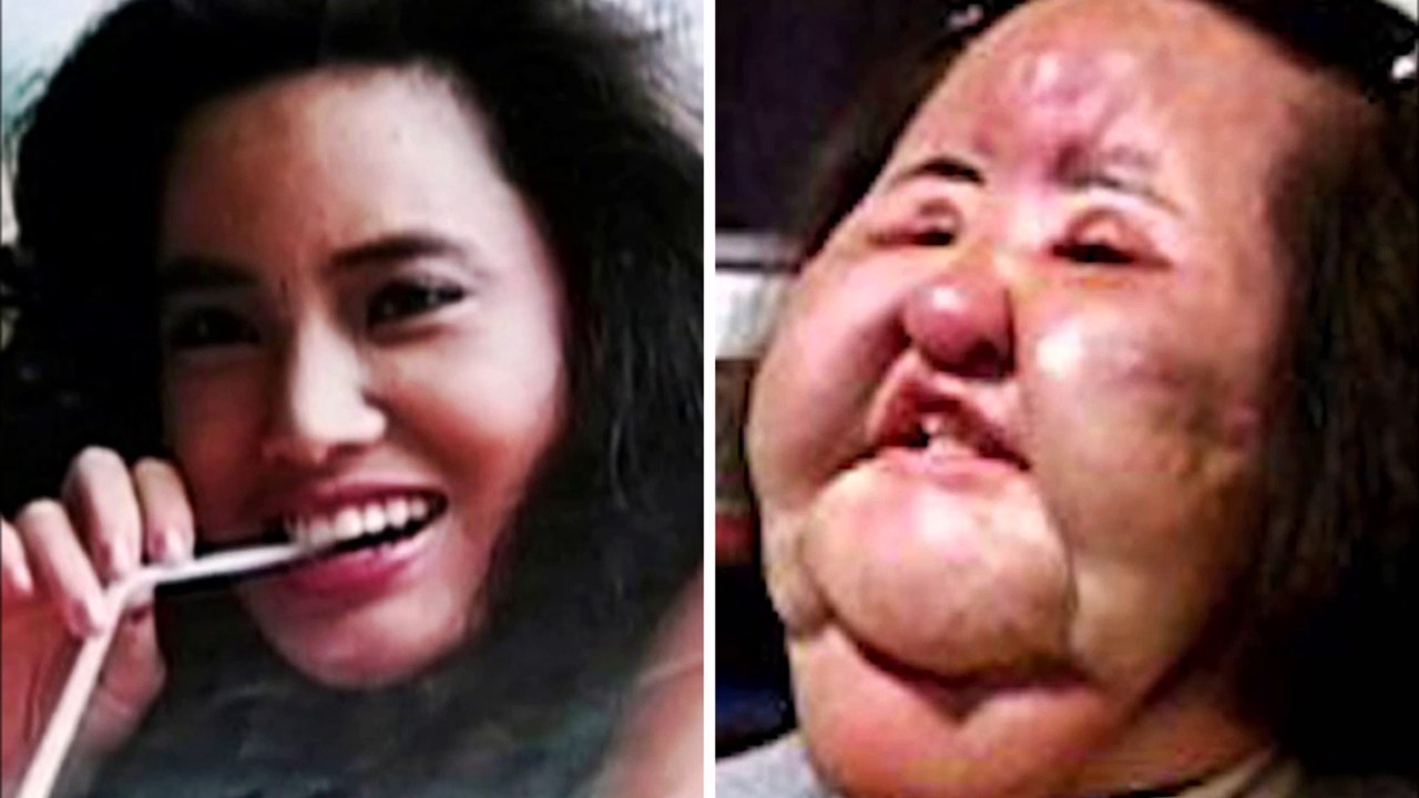 Shocking Plastic  Surgery