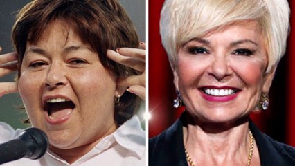 10 Most Expensive  celebrities plastic surgery