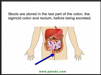 Crohn's Disease
