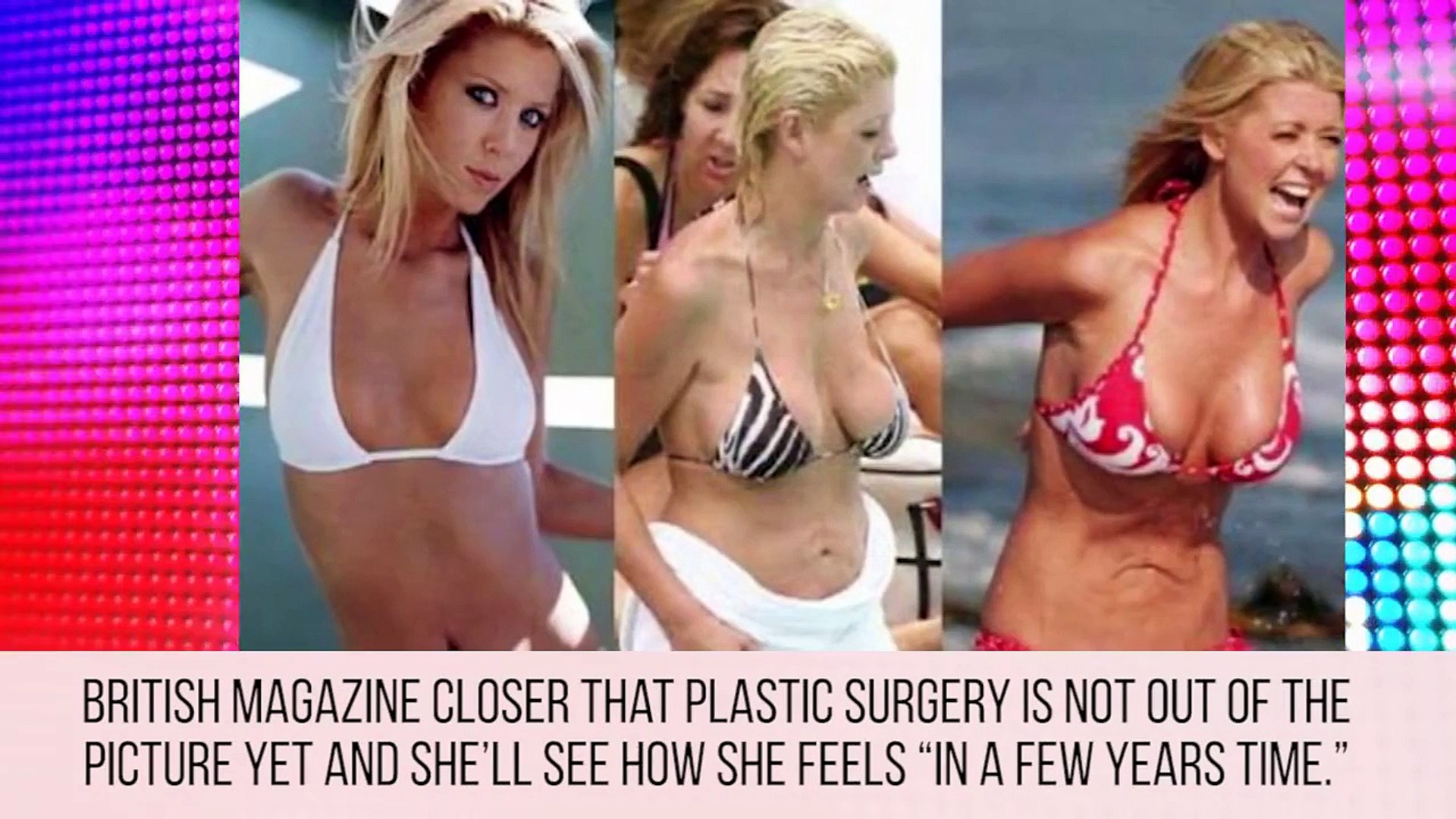 ⁣The Biggest Celebrity Plastic Surgery Fails