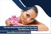 Tips And Herbal Supplements To Cure Acne That Will Clear Your Skin