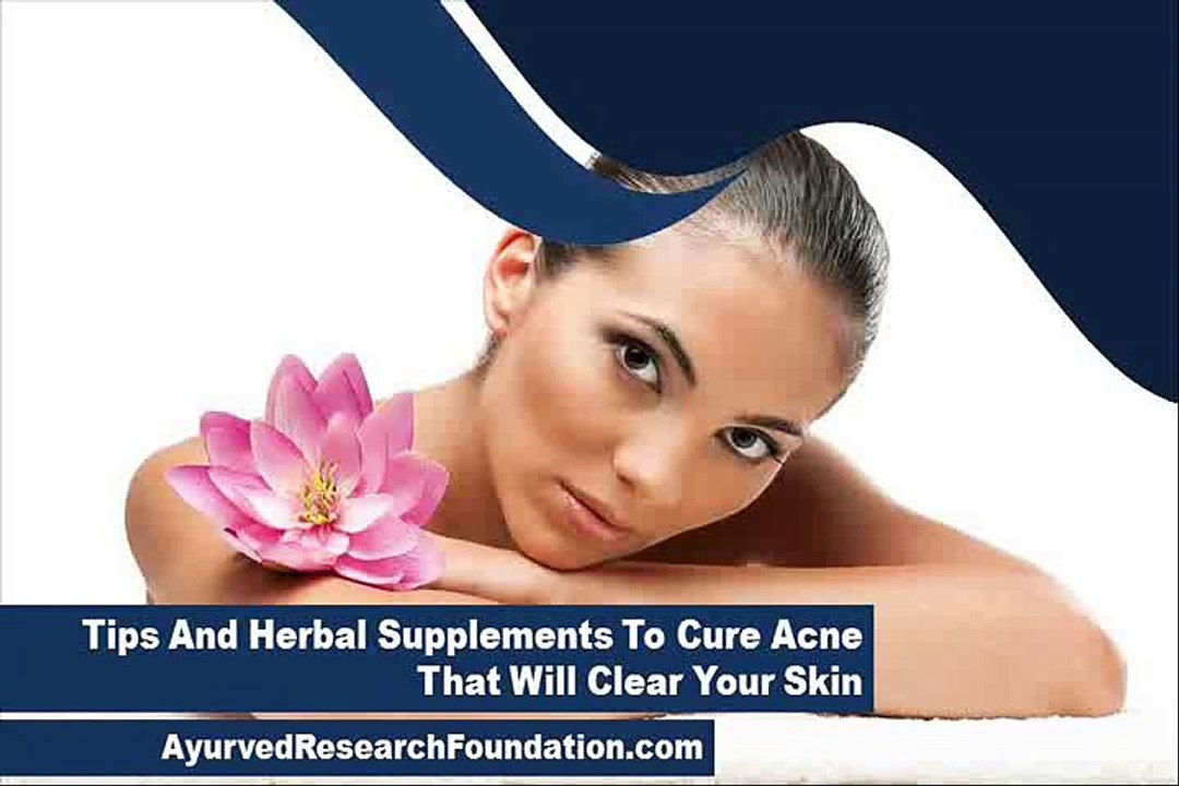 Tips And Herbal Supplements To Cure Acne That Will Clear Your Skin