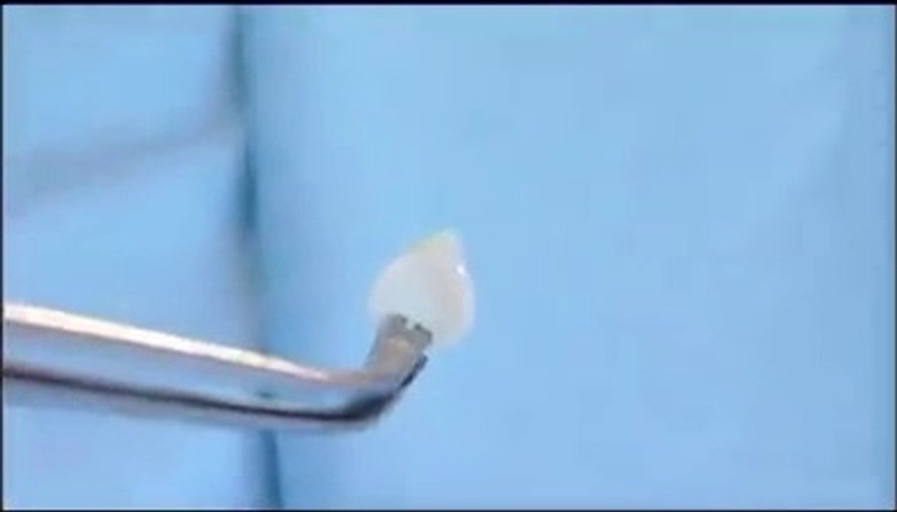 Teeth Implant prototype
