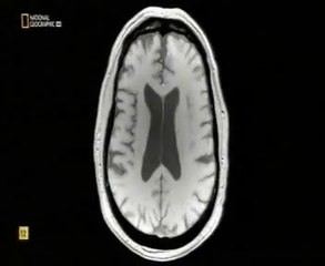 Claustro cerebral: Interruptor de la consciencia