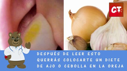 Despues de leer esto querras colocar un diente de ajo o cebolla en la oreja   REMEDIO NATURAL