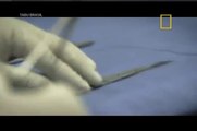 Tabu Brasil: Cirurgias Plasticas (Dublado) - Documentário National Geographic