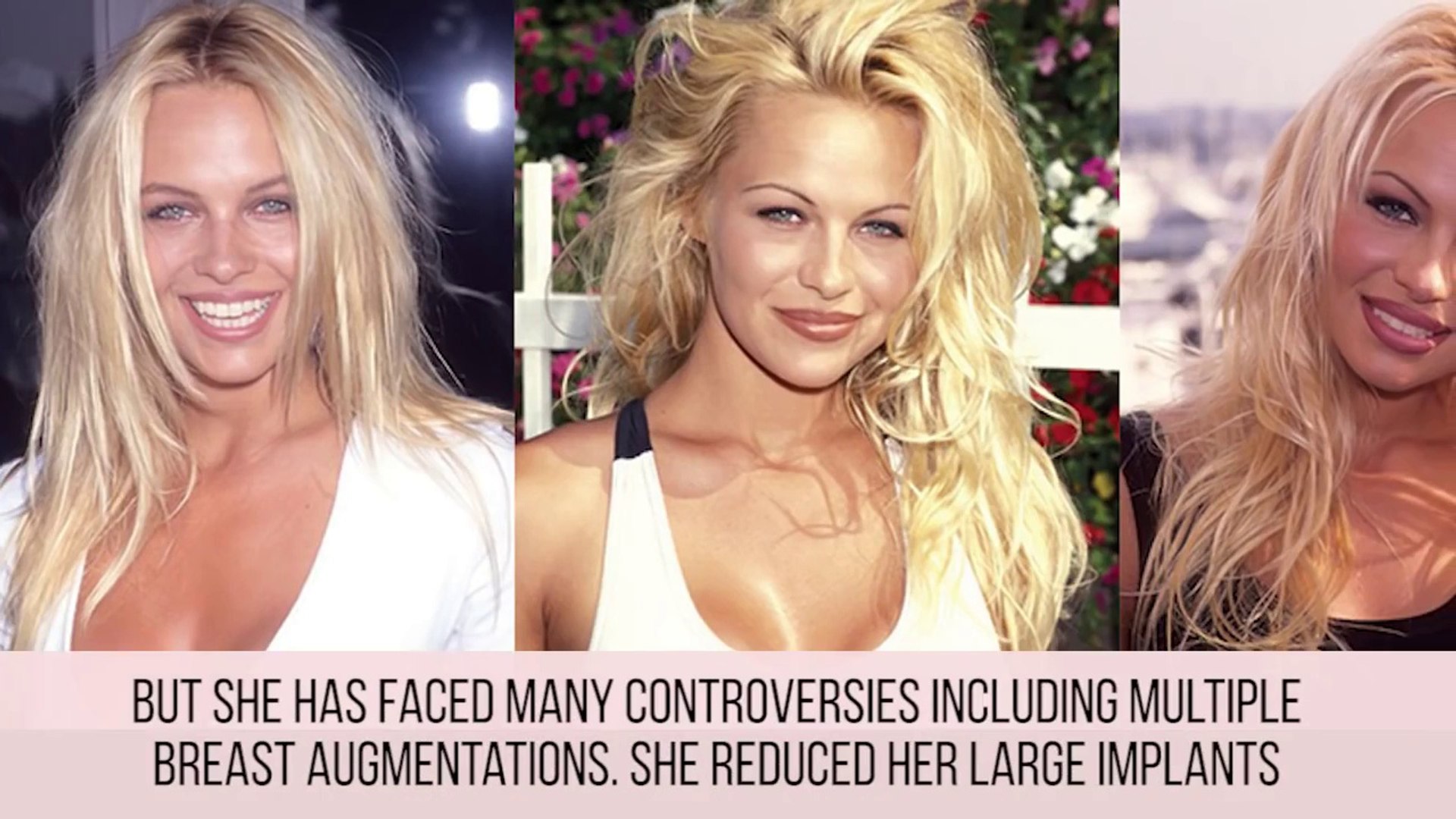 ⁣The Biggest Celebrity Plastic Surgery Fails