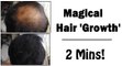 Quick Hair Growth - (Powder) *TEMPORARY*  - Hair Thinning Treatment || SuperwowStyle Prachi