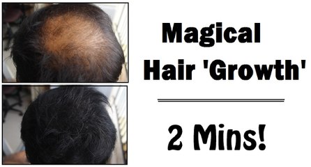 Quick Hair Growth - (Powder) *TEMPORARY*  - Hair Thinning Treatment || SuperwowStyle Prachi