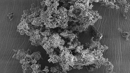 Les plombages et autre amalgames dentaires réalisés à partir de verre bioactif ?