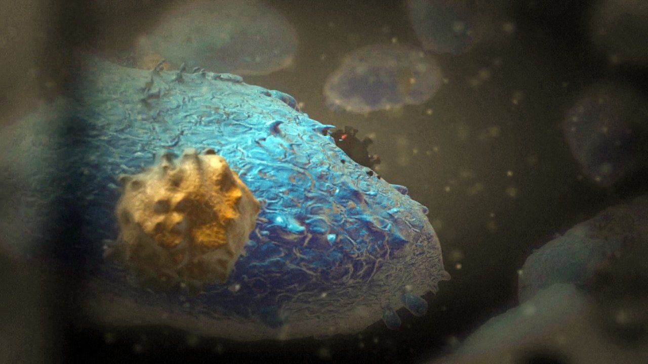 How Ebola attacks the body
