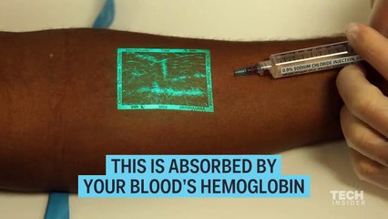 This incredible device makes the veins underneath your skin glow.