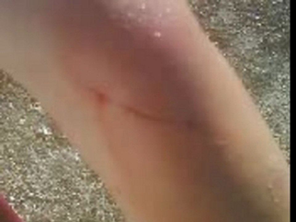 Gamellé en beauté
