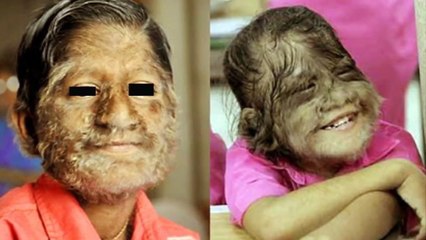 Top Ten Medical Mysteries