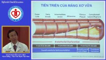 Bệnh động mạch vành - Gs.Ts Nguyễn Lân Việt_clip1