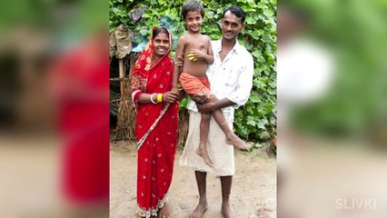 Топ5 ЛЮДЕЙ С ЛИШНИМИ ЧАСТЯМИ ТЕЛА