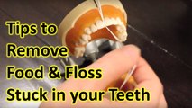 How to Remove Food Stuck in Teeth & Floss Stuck Between Teeth. My Teeth Pain Care