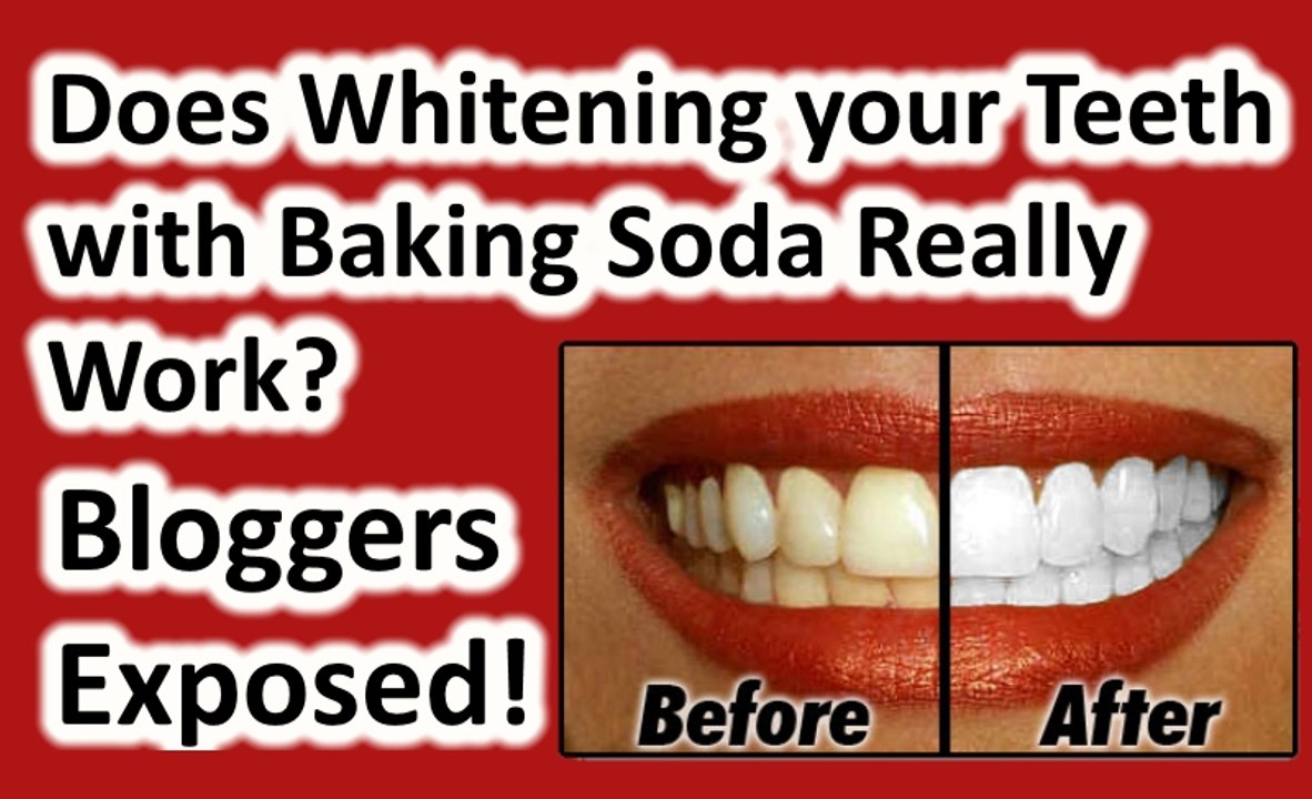 Can I whiten my teeth at home with Baking Soda Debunked! Does DIY