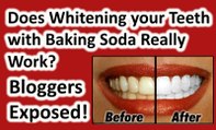Can I whiten my teeth at home with Baking Soda: Debunked! Does DIY whitening work?