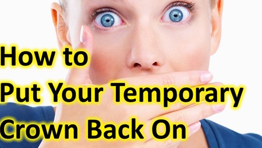 How to recement a Temporary Crown. Temporary crown fell 
