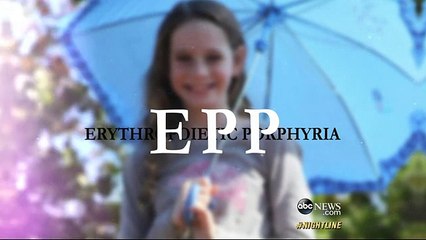 11-Year-Old Girl 'Allergic' to Sunlight  ABC News-copypasteads.com