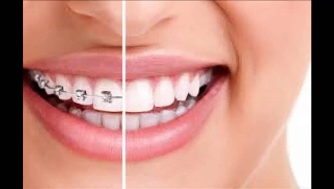 Orthodontics Davis
