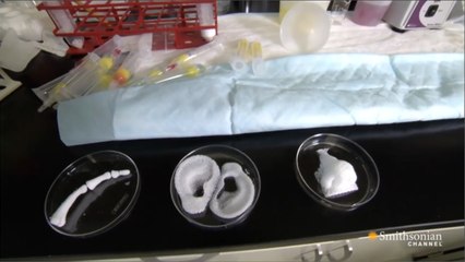 العلاج بأعضاء مستنبتة مخبريا بات وشيكا