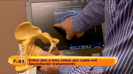 ¿Cómo tratar la inestabilidad de articulación de cadera de su hijo?